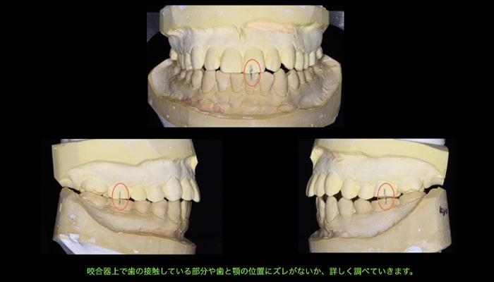 図２：歯と顎の位置にズレがないか診査